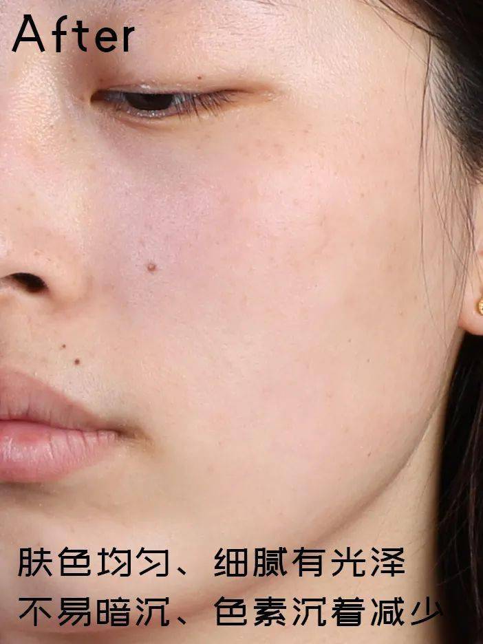 而且最近两天太阳还挺猛的,但是有了它们打击色素,抗氧化,抗光老化,再