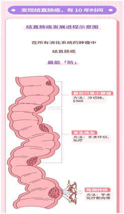胃癌排名_胃癌晚期图片(3)
