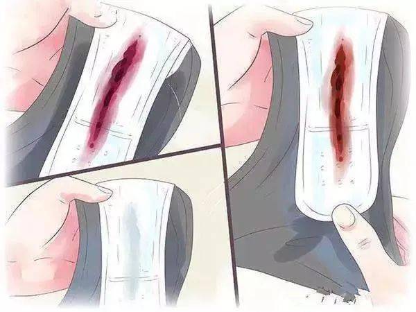 如何辨别恶露是否排干净小编教您一招