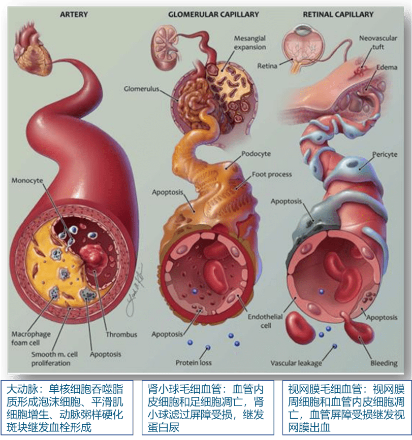 胰岛素的分泌过程图图片