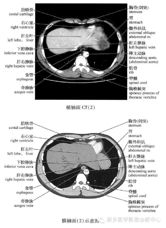 史上最全腹部横断位解剖详细标注