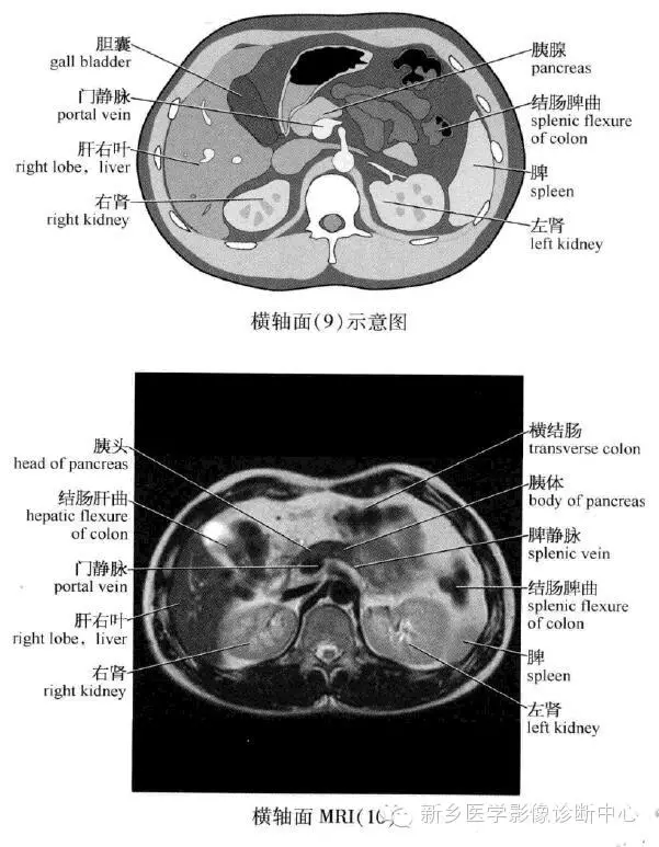 史上最全腹部横断位解剖详细标注