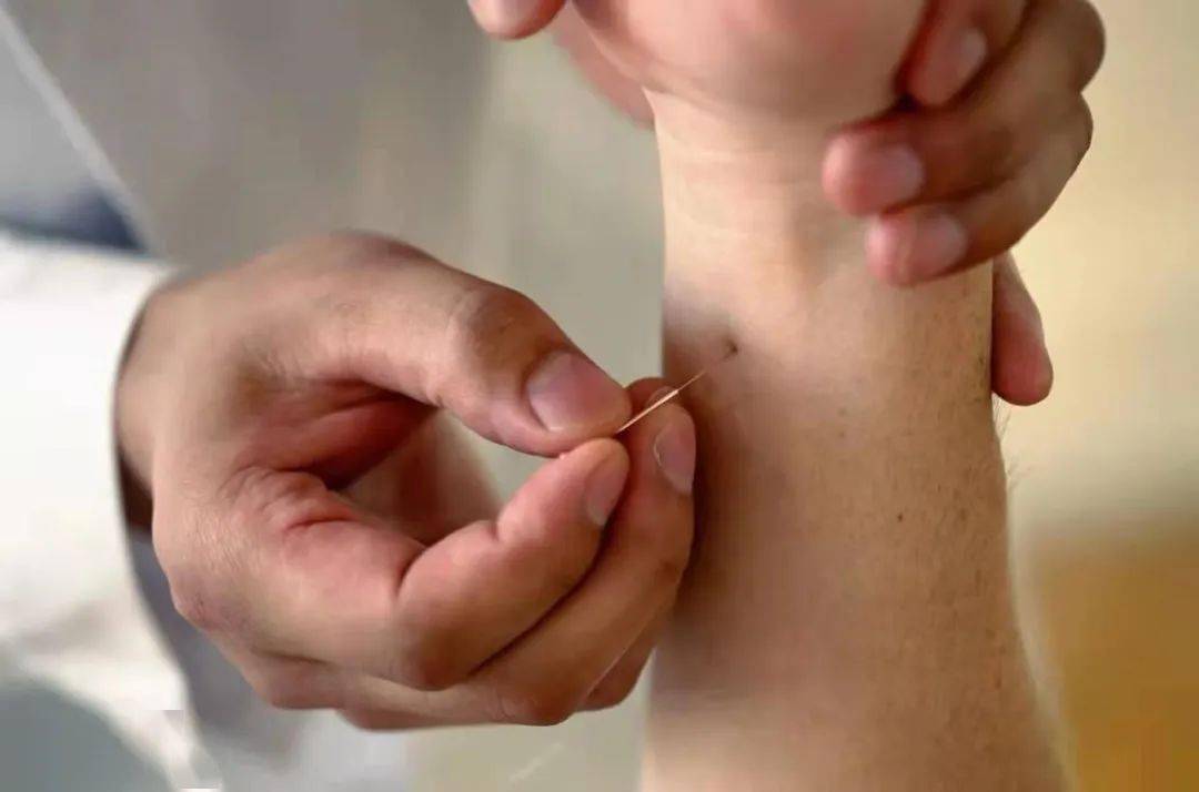 神奇!长久而严重的病,这小小银针就能搞定..._针灸