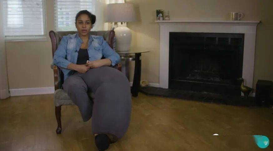 她天生一条腿巨粗无比被人当怪物盯着却依然自信美丽