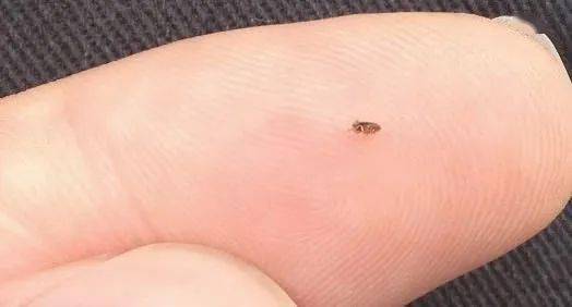 养猫贴士关于跳蚤的攻略