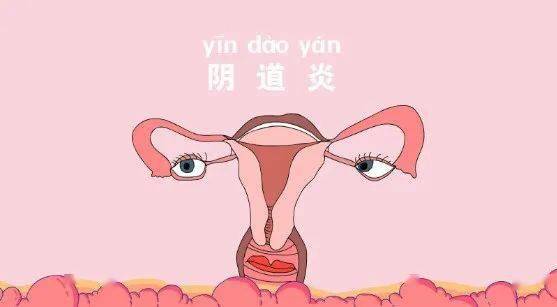 7种女性阴道炎的区分方法,你都学会了吗?_外阴