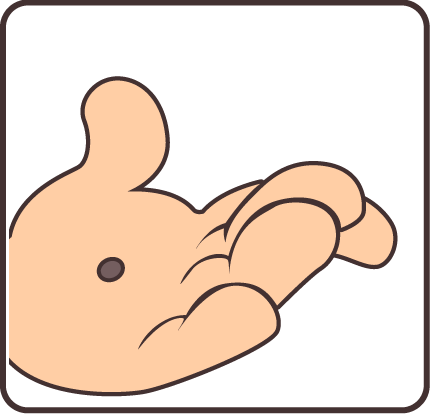 痣也可能会癌变!长在 3 个地方要注意