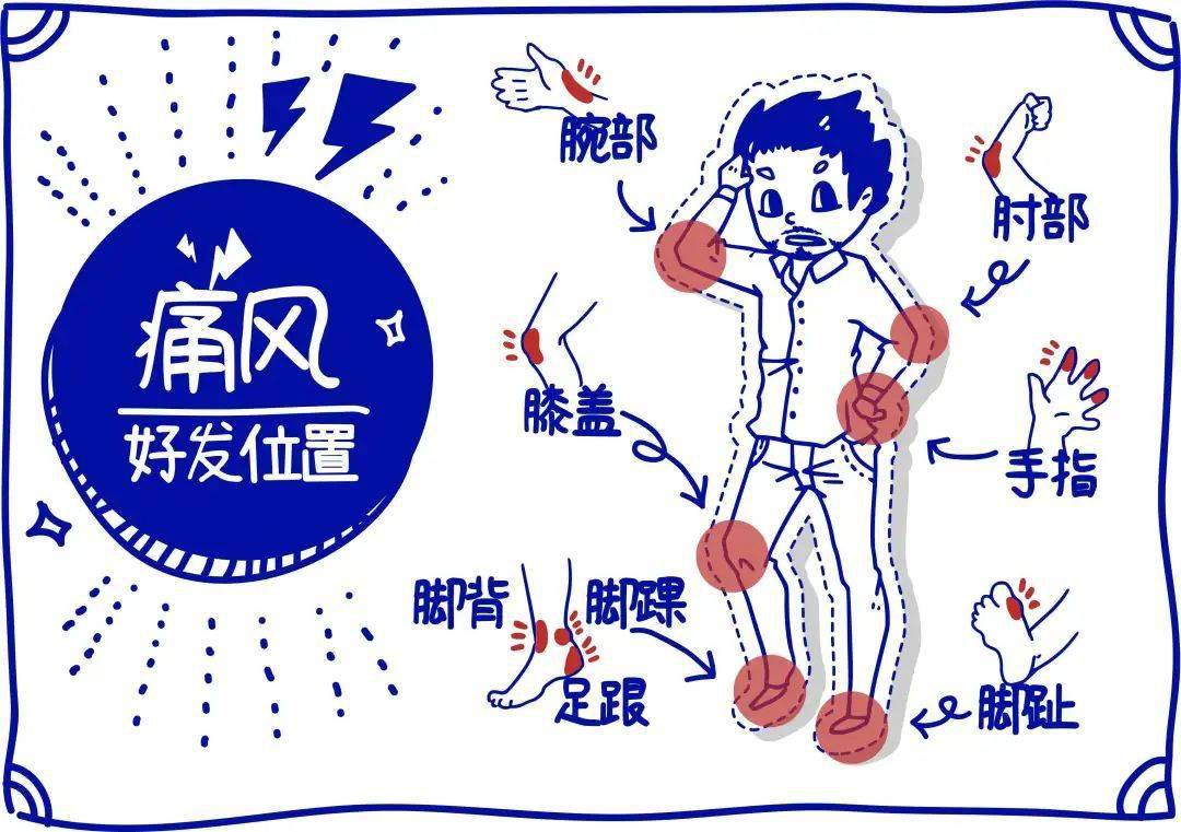 自测一下你的痛风是否恶化!