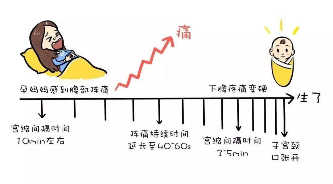 宫缩的曲线图图片