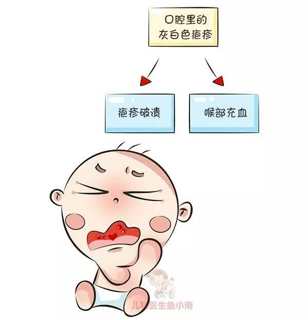 宝宝嗓子起泡怎么办