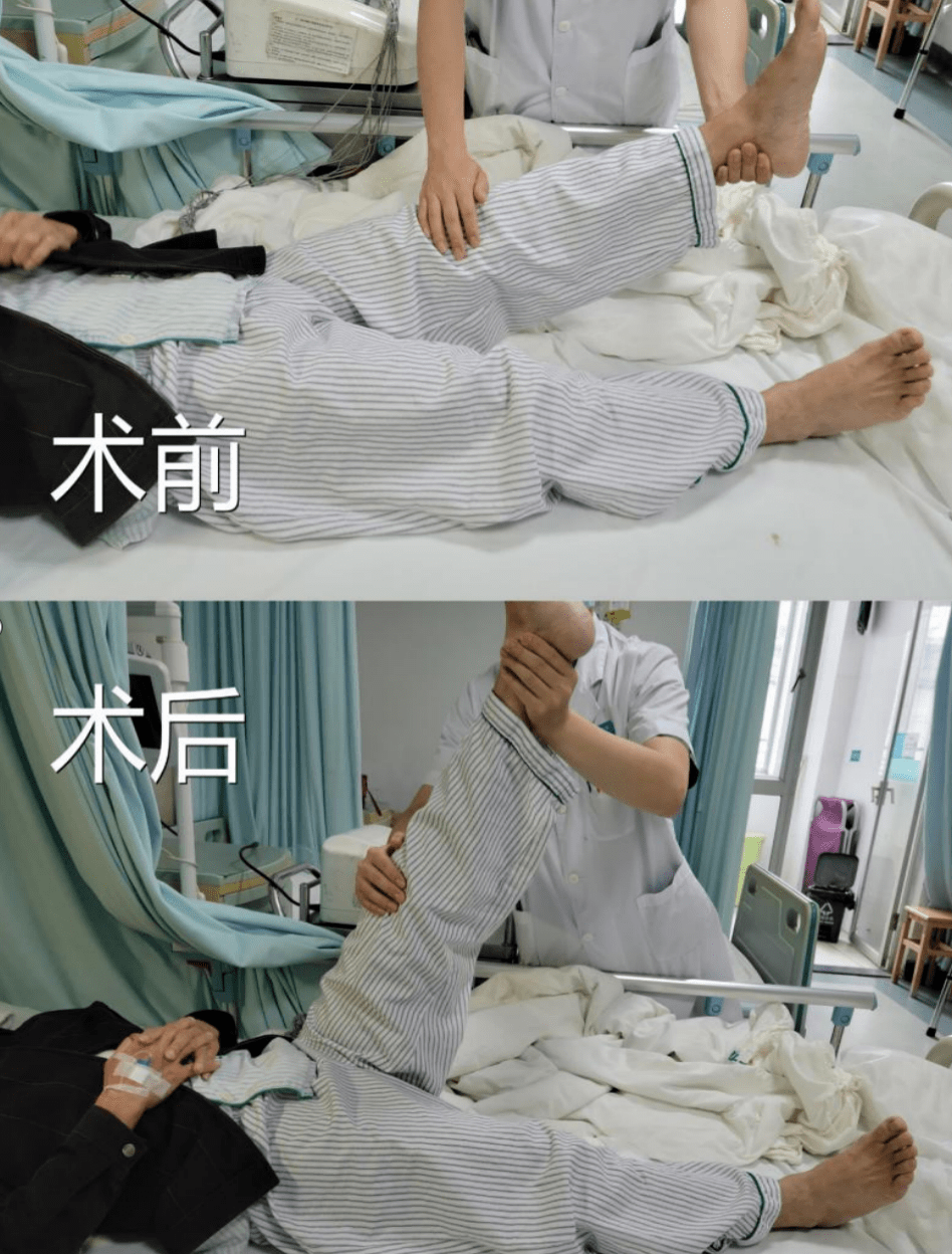 什么手术不需要开刀但要休息 6cf2f9e999094320b2f902c7242a4b05.png