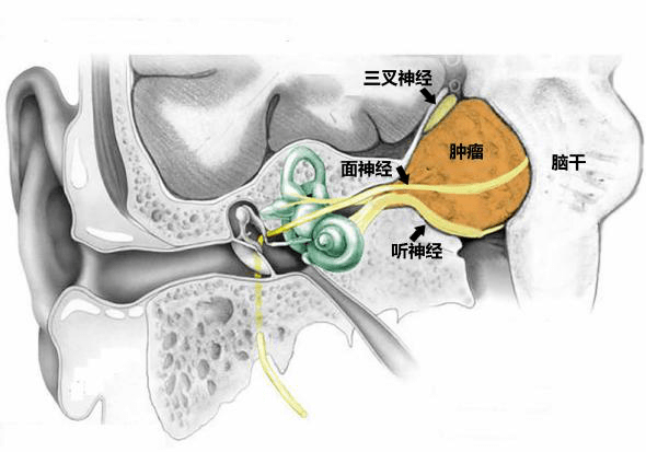 面听神经解剖图片