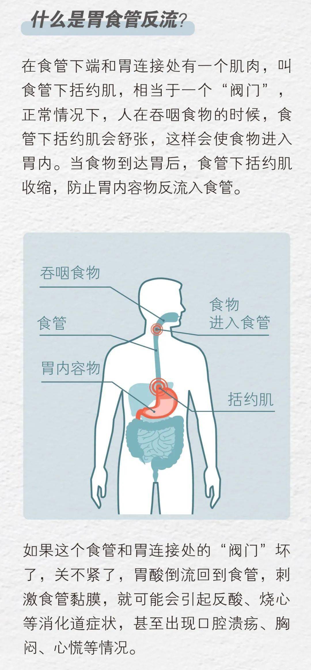 烧心是什么原理_烧心吃什么药