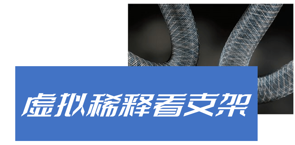 了一篇题为 visualization of flow diverter stent wall apposition