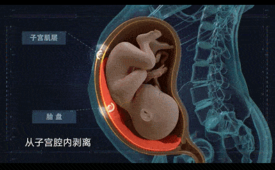 转胎丸阴阳人图片图片
