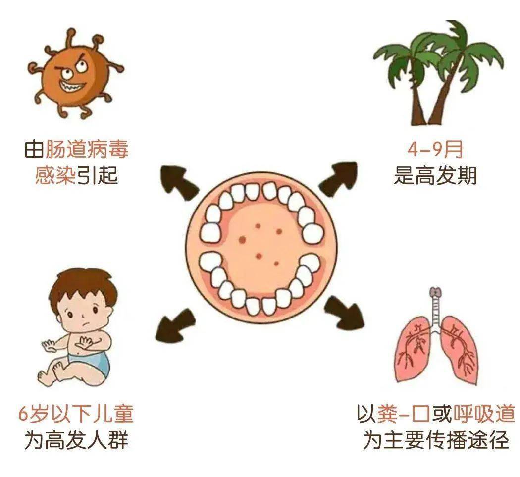 是兒童的多發病,常見病.皰疹性咽峽炎傳染嗎?如何