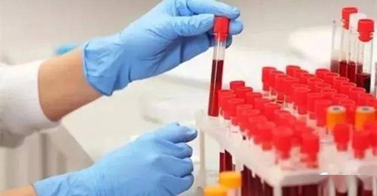 什么时候能治好尿毒症 7ddd9a79ecd74838b0ed32a960e0a67f.jpeg