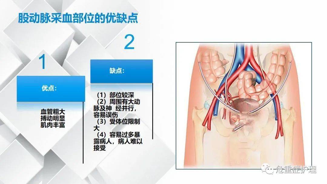 股动脉在哪个位置图片图片