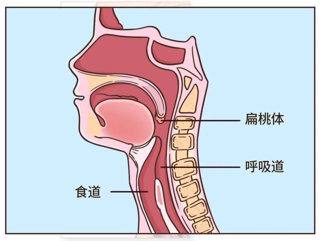 咽扁桃体的位置图片