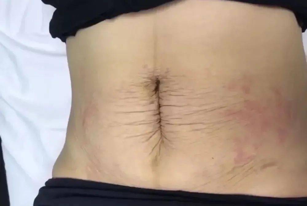 进行|产后漏尿、大肚子...如何开始修复？从这2个方面入手效果绝佳！