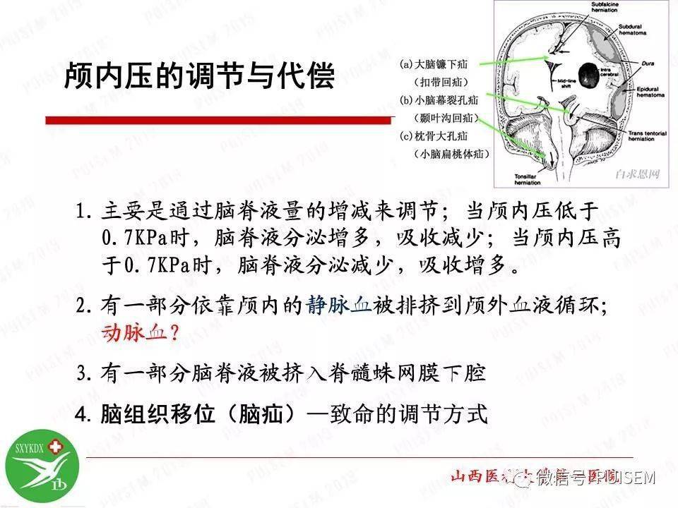 【ppt】颅内压的监测与管理