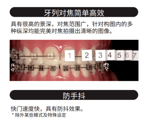 松风病例秀于雪松什么相机口腔专业摄影相机直出高清图正畸拍摄一个人