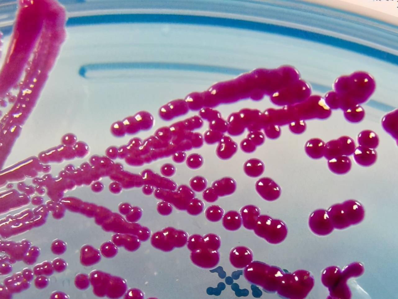 在不远的近海上,美军正在悄悄释放两种致病的细菌——粘质沙雷菌和