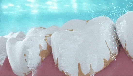 dd5154c69050455196b0a191d777e6f1.gif