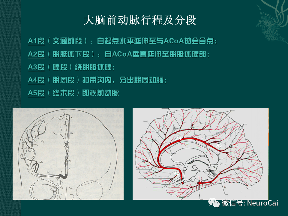 高清圖腦動脈解剖與ct重建