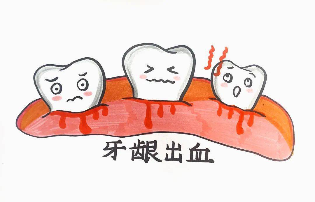 牙龈出血漫画图片