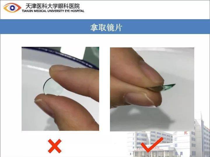 眼视光硬性角膜接触镜的摘戴方法