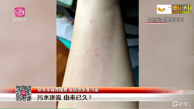年度最糟心业主：住深圳豪宅荟芳园小区 却喝粪水数月(图4)