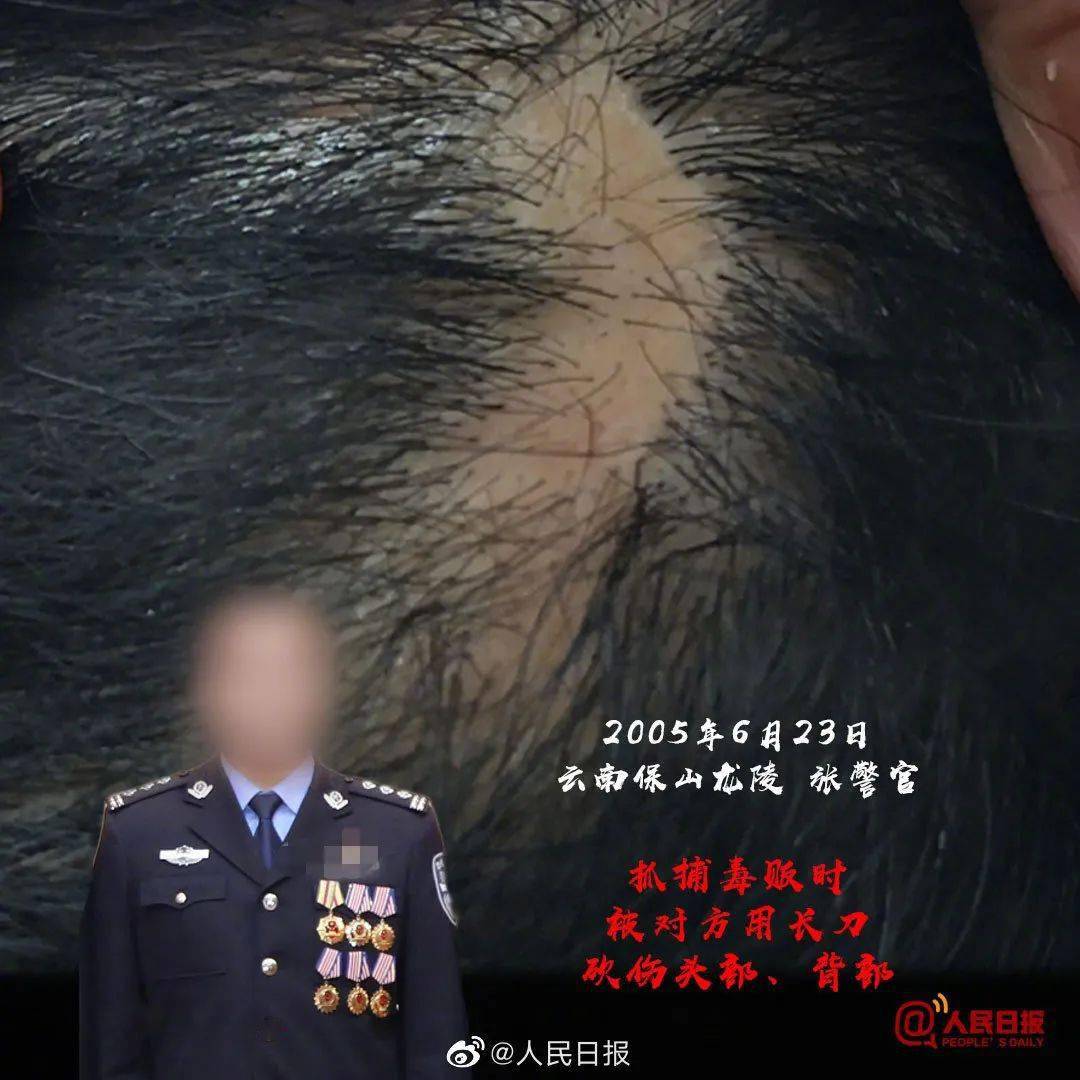 青听党史第十八期:《病榻受命——张子清身负重伤守井》 朗读者:詹