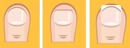 修剪|趾甲没剪对，能让人痛到抓心挠肝撕心裂肺？