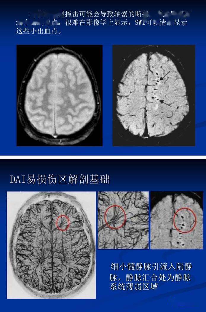 可同时获得幅度图像(magnitude image)和相位图像(phase image)