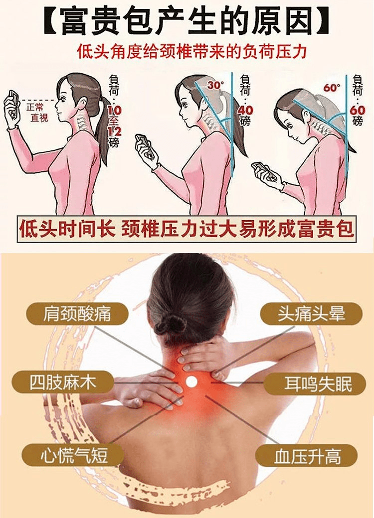 康復醫學科美麗計劃之穴位埋線正在火熱進行中