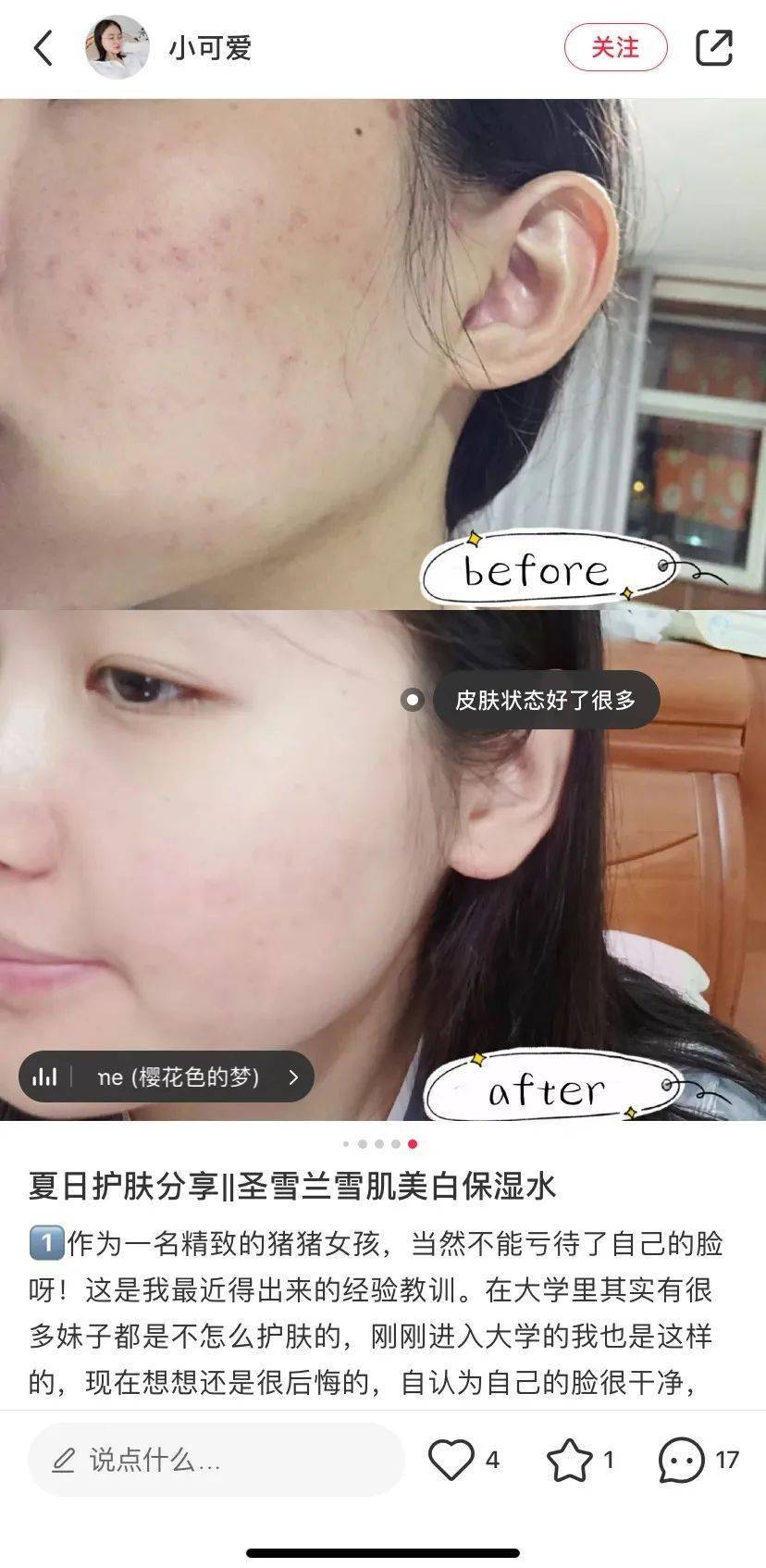 因为|美白水中的爱马仕，500ml超大桶完美取代2000元神仙水
