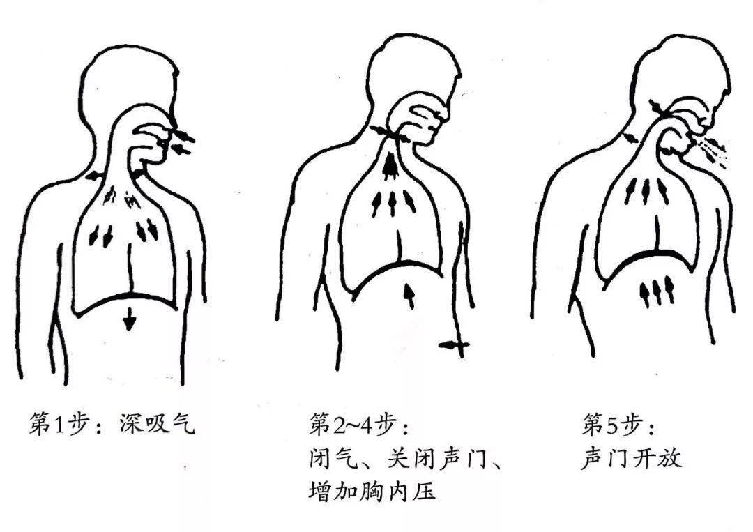 气管推移训练图解图片