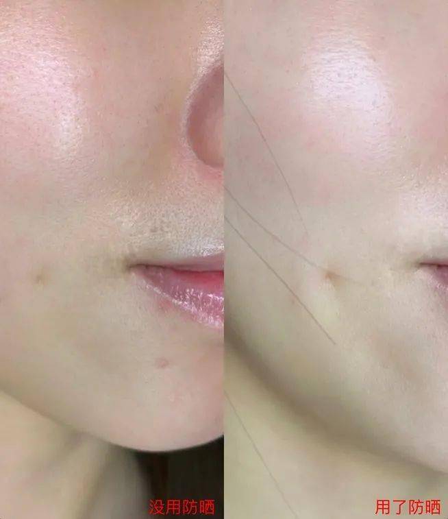 品牌|秒杀！5.5折安耐晒小金瓶！防晒、防黑、防衰老，一瓶全部拿下！