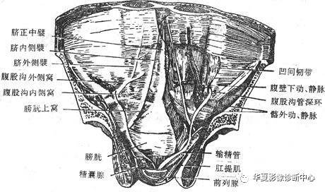 脐正中韧带图片