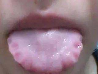 是什么原因引起的湿气重 27c5291ecf9e4389b000ef53999d65b1.jpeg