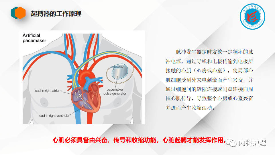 ppt起搏器术后的护理查房