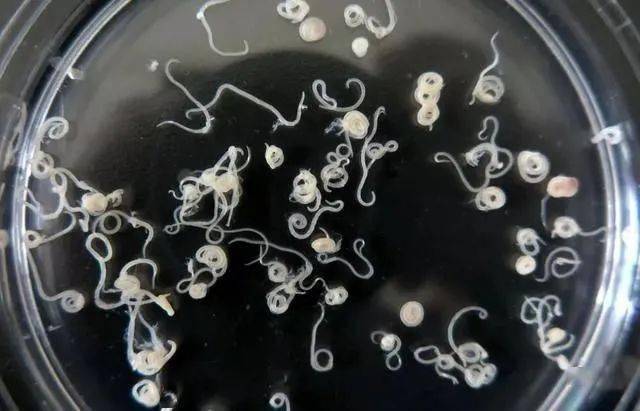 科普异尖线虫病科普知识