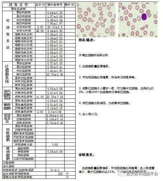 定量 eb病毒dna定量尿液分析凝血检查血常规实验室检查患者中年女性