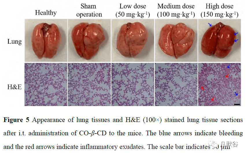 治疗细菌性肺炎的肉桂油β环糊精包合物粉雾剂研究