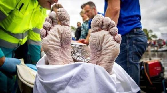 珍妮丝·布拉科维奇在比赛后的腿