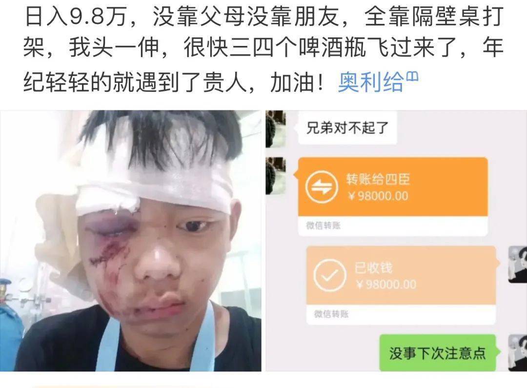 产品经理被老板打进医院只因其无法再造一个抖音