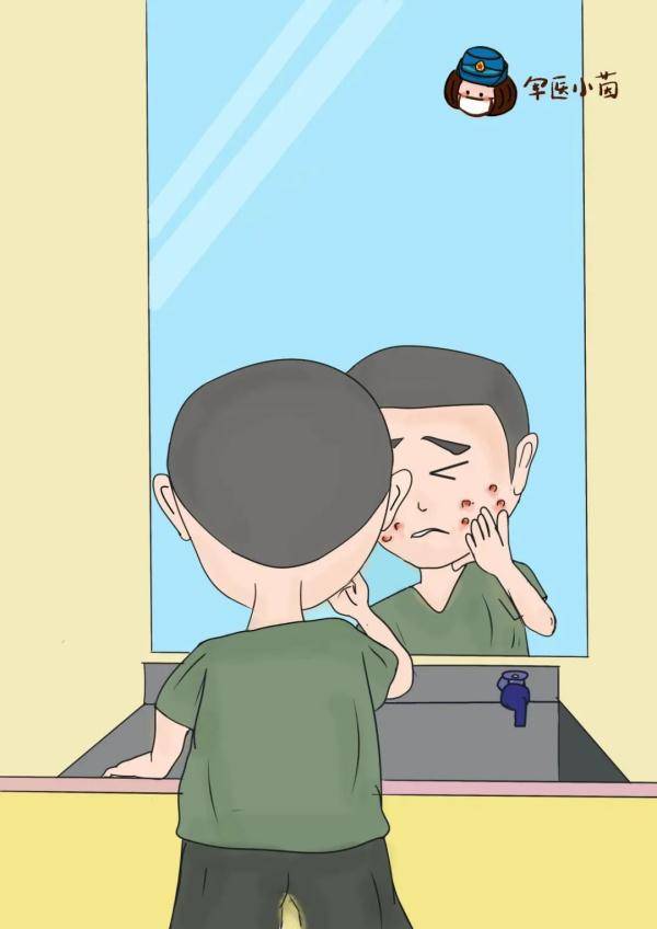 炎症|关于“痘痘”那些不得不说的事