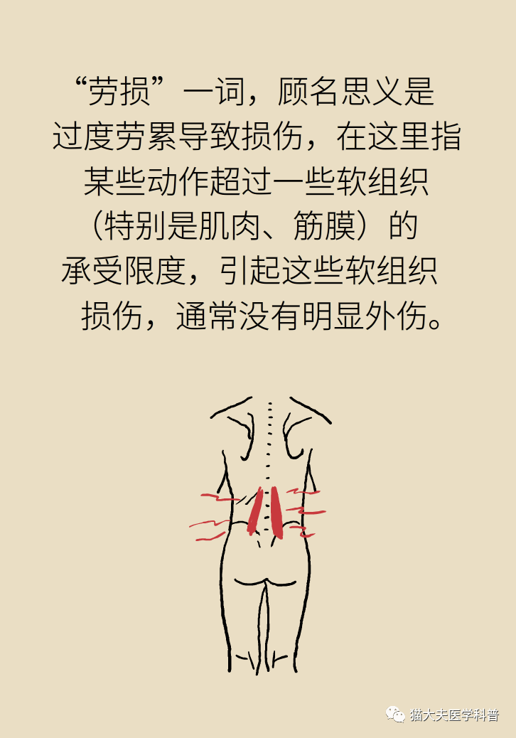 腰肌劳损怎么形成的图片