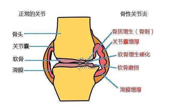 且行且珍 膝 关于膝关节疼痛的危害 听听医生怎么说 患者